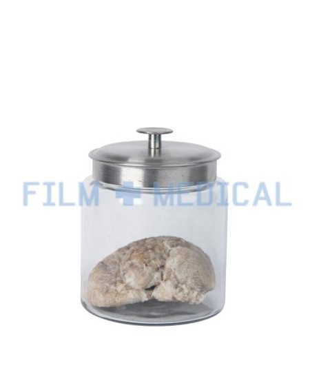 Brain Model In Glass Jar 